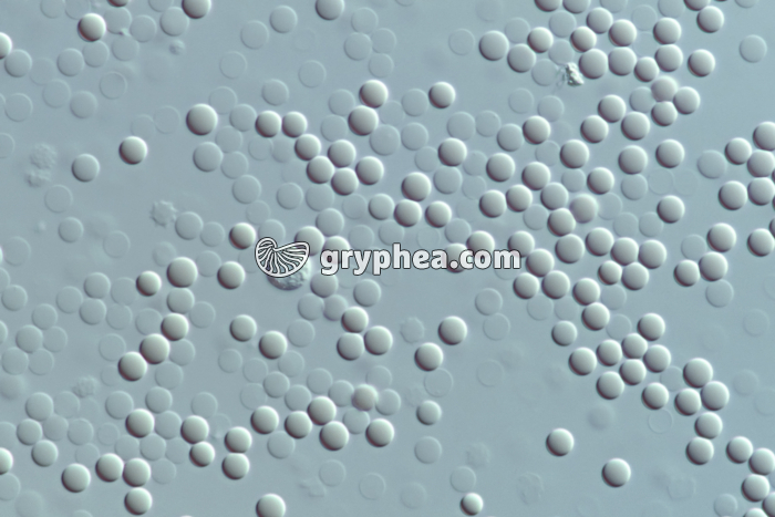 Hématies en milieu hypotonique (sang humain) x160 - gryphea.org